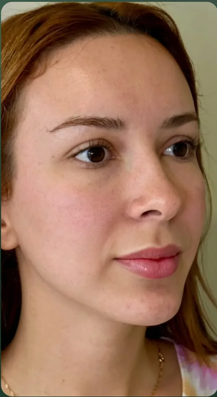 Depois do Full Face